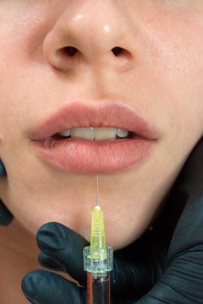 makes lip augmentation in the clinic